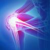 Photo for Elbow Lesion Market - Industry Analysis, Size, Share, Growth, Trends and Forecast to 2024