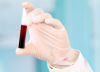 Photo for Global Blood Processing Devices and Consumables Market, By Product Type, and By Geography - Trends, Size, and Forecast from 2016 to 2024