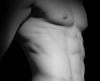 Photo for Male Liposuction – Get the Body You Always Dreamed About