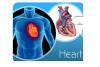 Photo for PROSTHETIC HEART VALVE MARKET - GLOBAL INDUSTRY INSIGHTS 2016-2024