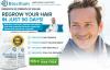 Photo for What Is Biocilium Hair Growth?