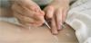 Photo for Global Acupuncture Treatment Instrument Market Professional Survey Report 2017