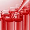 Photo for Global Dispersants Market by Manufacturers, Countries, Type and Application, Forecast to 2022