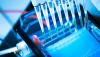Photo for Global In Vitro Diagnostics (IVD) Market Analysis & Forecast, 2016–2024