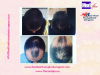 Photo for Hair transplant doctor – Choose an experienced and skilled surgeon