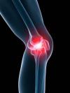 Photo for MediPoint: Hip and Knee Reconstruction?—?Global Analysis and Market Forecasts