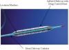 Photo for Drug Eluting Stents Market – Global Industry Insights, Trends ,Analysis, 2016–2024