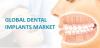 Photo for Global Dental Implants Market To Surpass US$ 6269.8 Million By 2024