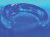 Photo for Global Medical Grade Hydrogel Market by Manufacturers, Countries, Type and Application, Forecast to 2022