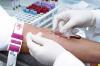 Photo for Global Companion Diagnostics Market set to increase significantly by 2024