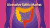 Photo for Ulcerative Colitis Market – Global Industry Insights, Trends and Opportunity Analysis, 2016–2024