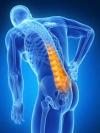 Photo for Back Pain