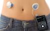 Photo for Global Insulin Pump Market Report 2017(Normal/Patch Pump)[Type I Diabetes/Type II Diabetes]