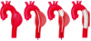 Photo for Global Stent Grafts Market by Manufacturers, Countries, Type and Application, Forecast to 2022