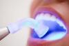 Photo for Dental Curing Lights Market Dynamics And Growth Rate 2017-2021