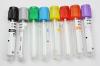Photo for Global Vacutainer Market by Manufacturers, Countries, Type and Application, Forecast to 2022