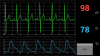 Photo for Global Vital Signs Monitoring Market to record high demand by 2016-2024