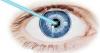 Photo for Ophthalmic Femtosecond Lasers Market – Global Industry Insights, Size, Share, Trends, and Opportunity Analysis, 2017–2025