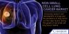 Photo for Non-Small Cell Lung Cancer Market – Global Industry Insights, Trends and Opportunity Analysis, 2016–2024