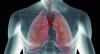 Photo for Cystic Fibrosis Market – Global Industry Insights, Trends, and Opportunity Analysis, 2016–2024