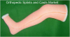 Photo for Orthopedic Splints and Casts Market – Global Industry Insights, Trends, Size, Share, and Opportunity Analysis, 2017–2025
