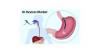 Photo for Gastrointestinal Devices Market - Global Industry Insights, Size, Share and Analysis, 2016 - 2024
