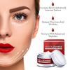 Photo for How Does Derma Rewind Work?