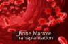 Photo for Bone Marrow Transplant Market – Global Industry Insights, Trends, and Opportunity Analysis, 2016–2024
