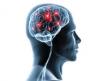 Photo for Neurologist in Chennai