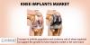 Photo for Knee Implants Market - Industry Analysis, Size, Share, Growth, Trends and Forecast to 2025