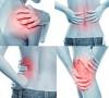 Photo for Musculoskeletal Pain-Global API Manufacturers, Marketed and Phase III Drugs Landscape, 2017