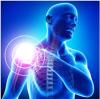 Photo for Moderate Pain-Global API Manufacturers, Marketed and Phase III Drugs Landscape, 2017