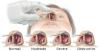 Photo for Nasal Congestion-Global API Manufacturers, Marketed and Phase III Drugs Landscape, 2017