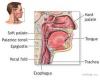 Photo for Nasopharyngitis (Common Cold)-Global API Manufacturers, Marketed and Phase III Drugs Landscape, 2017
