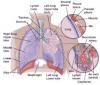 Photo for Non-Small Cell Lung Cancer-Global API Manufacturers, Marketed and Phase III Drugs Landscape, 2017
