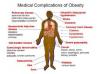 Photo for Obesity-Global API Manufacturers, Marketed and Phase III Drugs Landscape, 2017