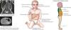 Photo for Neuroblastoma-Global API Manufacturers, Marketed and Phase III Drugs Landscape, 2017