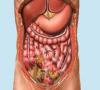 Photo for Peritonitis-Global API Manufacturers, Marketed and Phase III Drugs Landscape, 2017