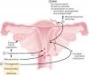 Photo for Primary Dysmenorrhea-Global API Manufacturers, Marketed and Phase III Drugs Landscape, 2017