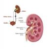 Photo for Renal Stones/Calculi-Global API Manufacturers, Marketed and Phase III Drugs Landscape, 2017