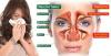 Photo for Sinusitis-Global API Manufacturers, Marketed and Phase III Drugs Landscape, 2017