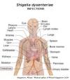 Photo for Shigella Infections (Shigellosis)-Global API Manufacturers, Marketed and Phase III Drugs Landscape, 2017
