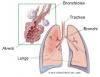 Photo for Streptococcus Pneumoniae (Pneumococcus) Infections-Global API Manufacturers, Marketed and Phase III Drugs Landscape, 2017