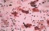 Photo for Streptococcal Infections-Global API Manufacturers, Marketed and Phase III Drugs Landscape, 2017