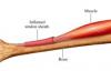 Photo for Tenosynovitis-Global API Manufacturers, Marketed and Phase III Drugs Landscape, 2017