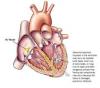 Photo for Ventricular Arrhythmia-Global API Manufacturers, Marketed and Phase III Drugs Landscape, 2017