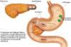 Photo for Zollinger-Ellison Syndrome (Gastrinoma)-Global API Manufacturers, Marketed and Phase III Drugs Landscape, 2017