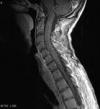 Photo for Meningeal Leukemia-Global API Manufacturers, Marketed and Phase III Drugs Landscape, 2017