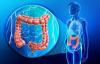 Photo for Metastatic Colorectal Cancer-Global API Manufacturers, Marketed and Phase III Drugs Landscape, 2017
