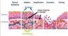 Photo for Oral Mucositis-Global API Manufacturers, Marketed and Phase III Drugs Landscape, 2017
